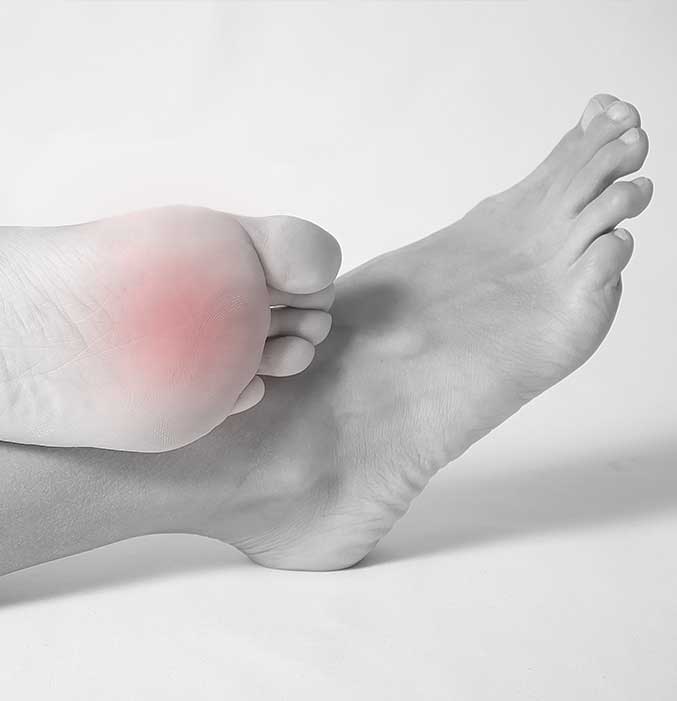 Metatarsal Foot Pain 