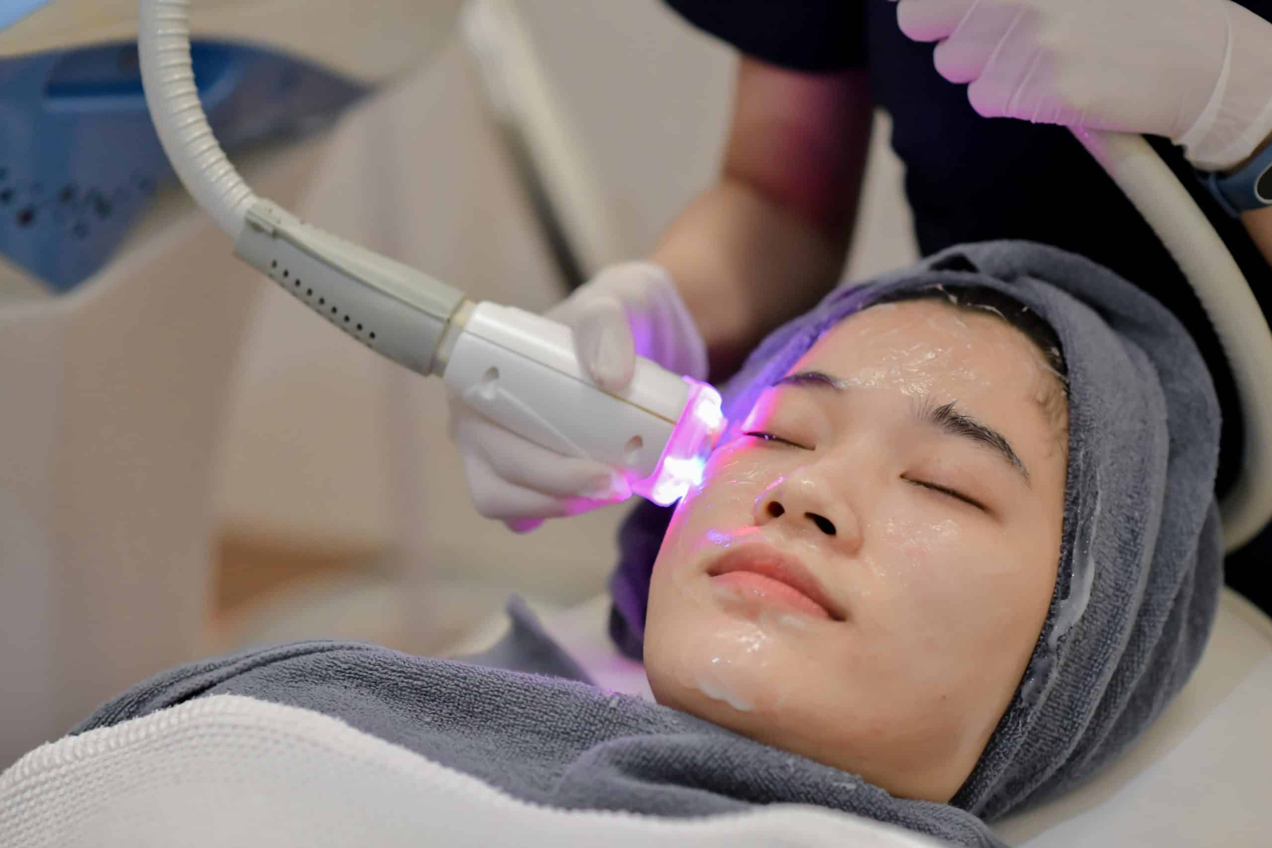 Skin Laser Treatment