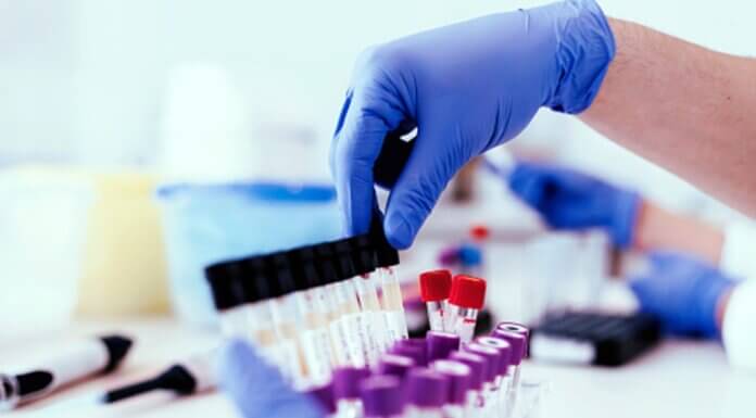 How To Choose The Right Drug & Alcohol Test Kit?