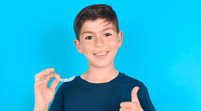 Why Clear Aligners Are the Best Choice for Adults Clear Aligners