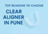 Top Reasons to Choose Clear Aligner in Pune Clear Aligner in Pune