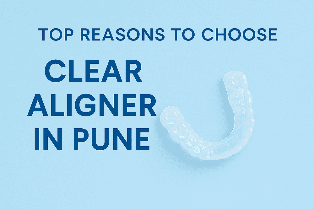 Clear Aligner in Pune Clear Aligner in Pune