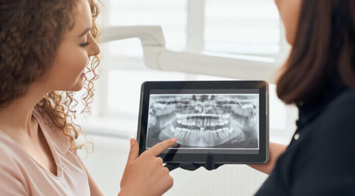 CAD-CAM Precision in Aligner Design: Accuracy & Efficiency CAD CAM Precision in Aligner Design