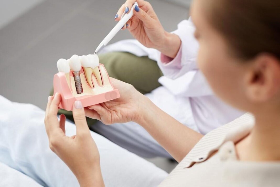 Dental Implants Edensor Park