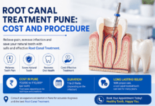 Root Canal Treatment Pune: Cost and Procedure Root Canal Treatment Pune