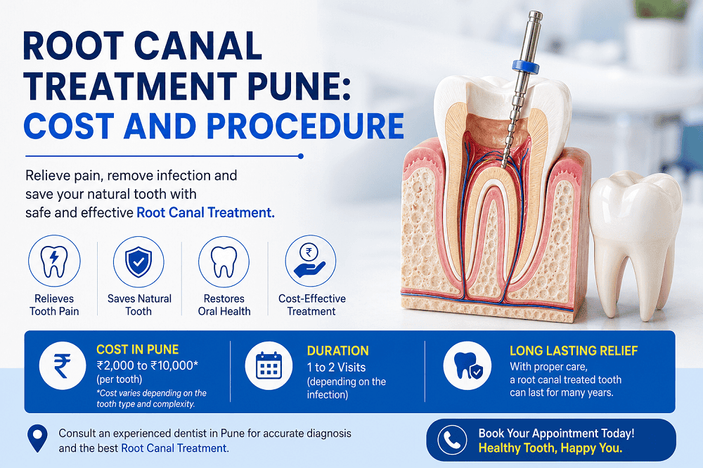 Root Canal Treatment Pune Root Canal Treatment Pune